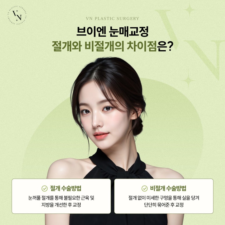 눈매교정, 비절개로도 가능한가요? 관련 이미지 3