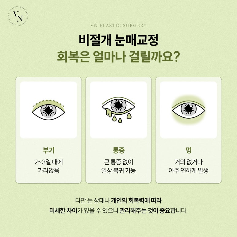 눈매교정, 비절개로도 가능한가요? 관련 이미지 5