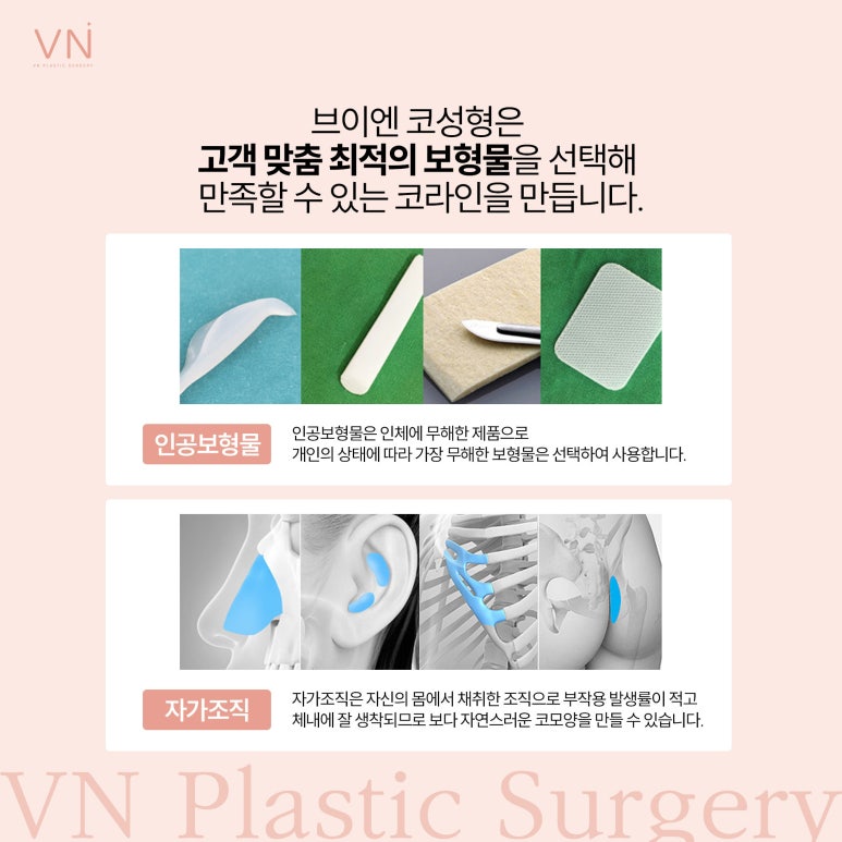 개인별 유형에 따른 코성형 수술방법 관련 이미지 5
