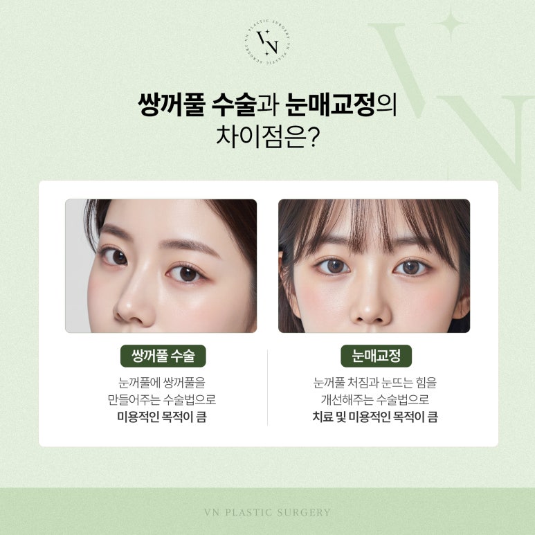 브이엔성형외과, 쌍꺼풀 수술과 눈매교정 차이점은? 관련 이미지 4
