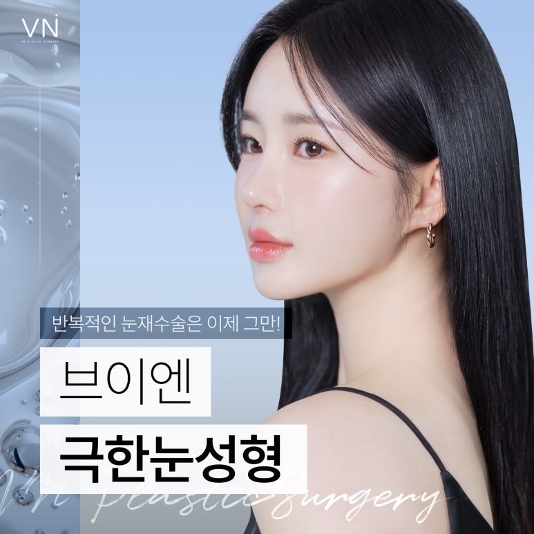 눈 성형의 끝판왕, 극한눈성형 관련 이미지 1