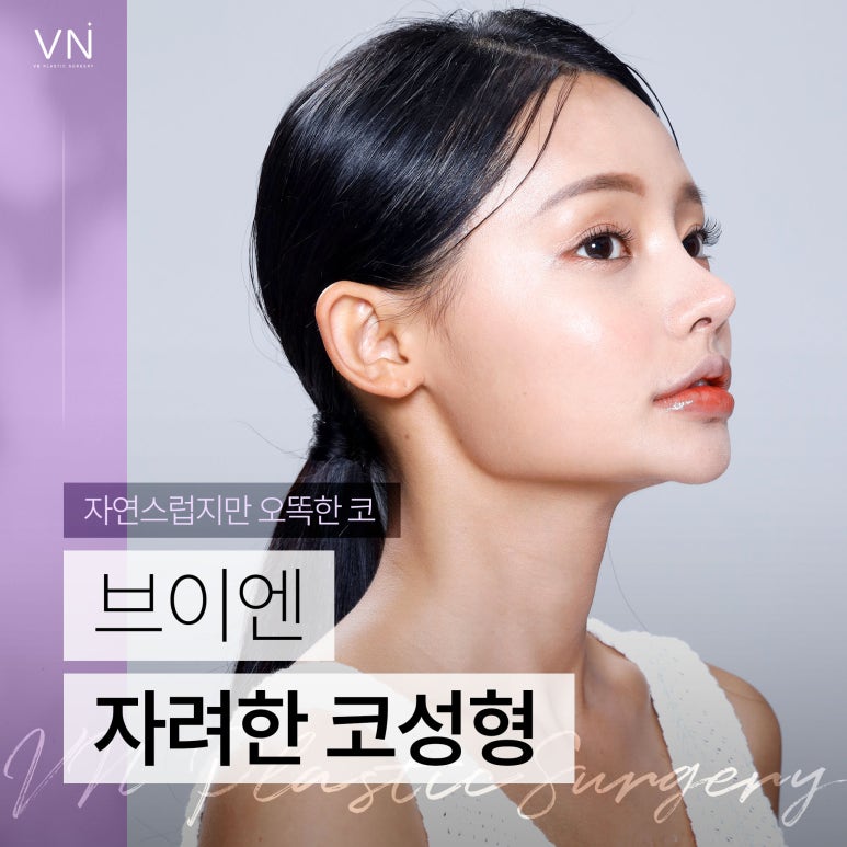 자연스럽지만 오똑한 코, 자려한 코성형 관련 이미지 1