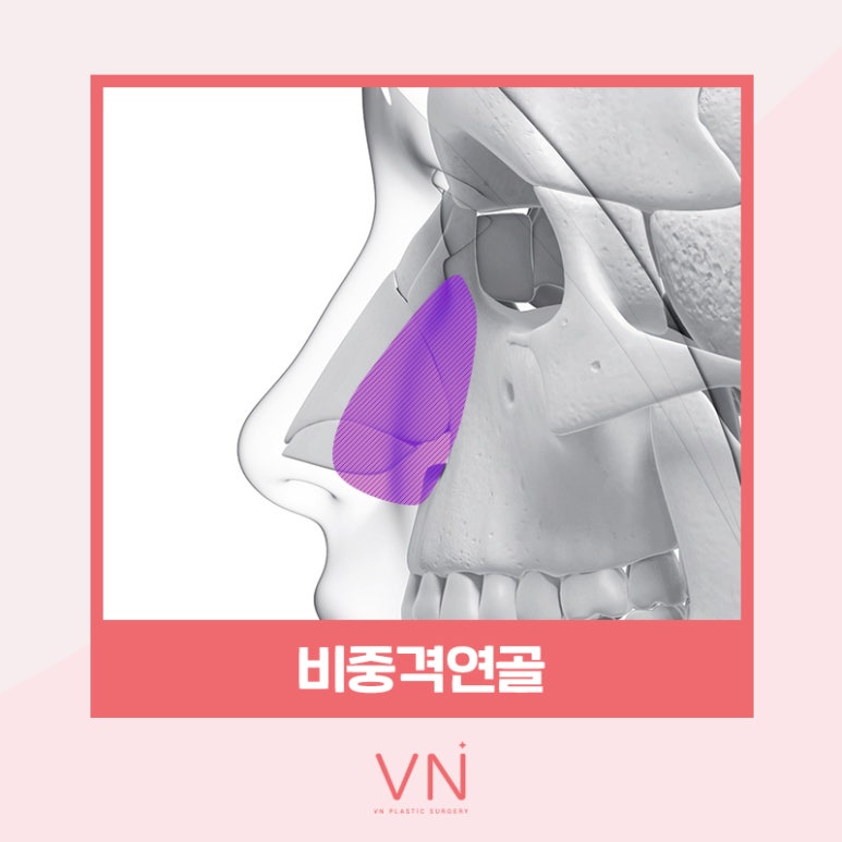 코성형수술 전이라면 클릭🖱 (feat. 수술재료 모아보기) 관련 이미지 5