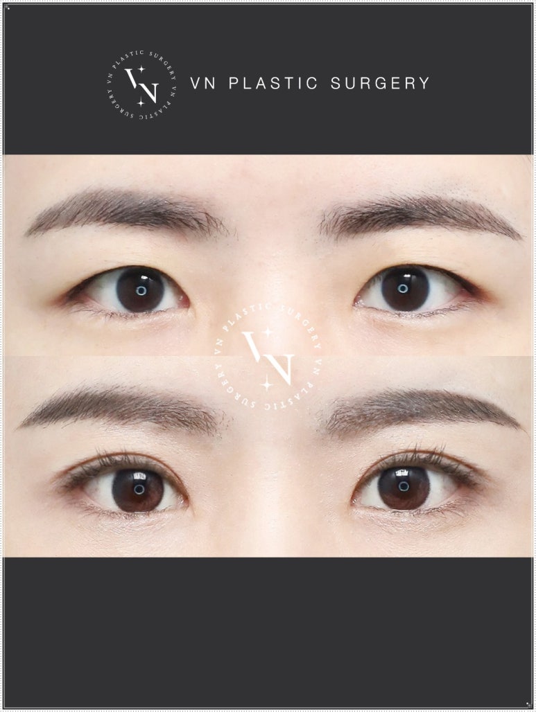 Turn Your Complexes into Confidence: How to Apply for the VN Plastic Surgery Real Model Program image 4