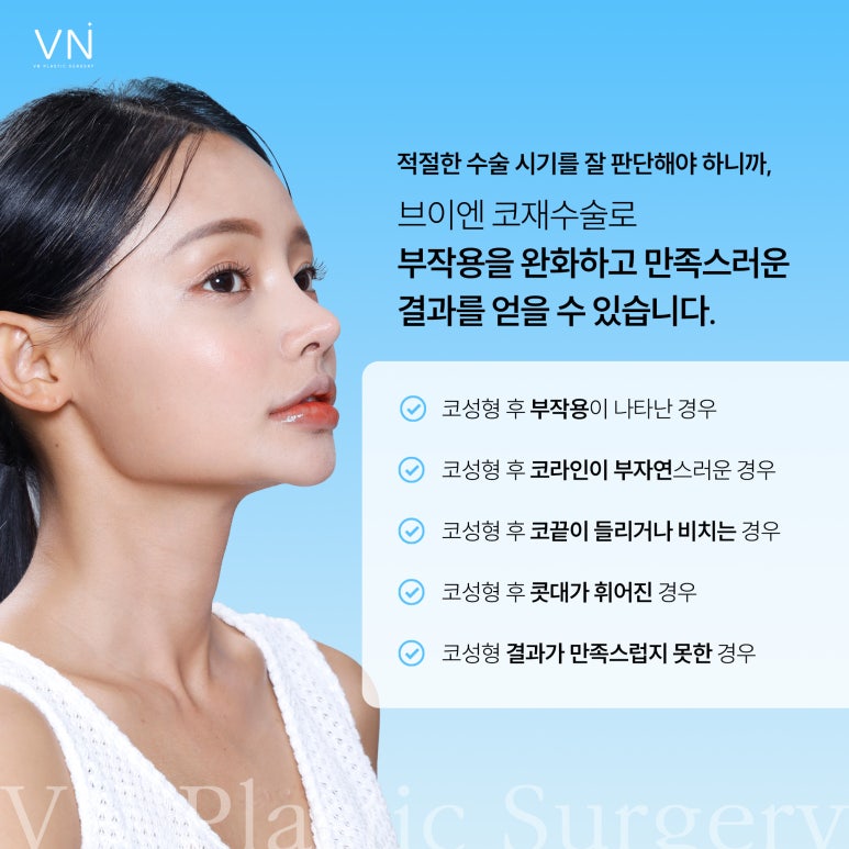 What Is the Right Time for Revision Rhinoplasty? image 5