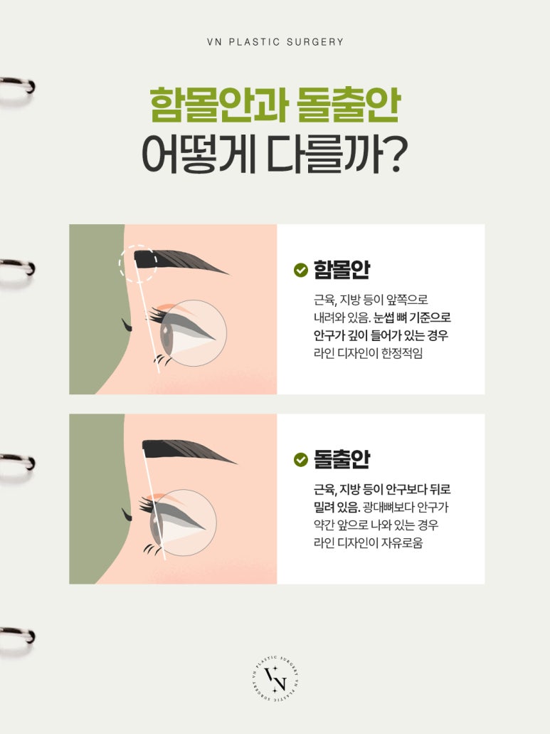 [Sinnonhyeon Plastic Surgery] Before Your First Double Eyelid Surgery, Be Sure to Check This! Do I Have Sunken Eyes or Protruding Eyes? image 2