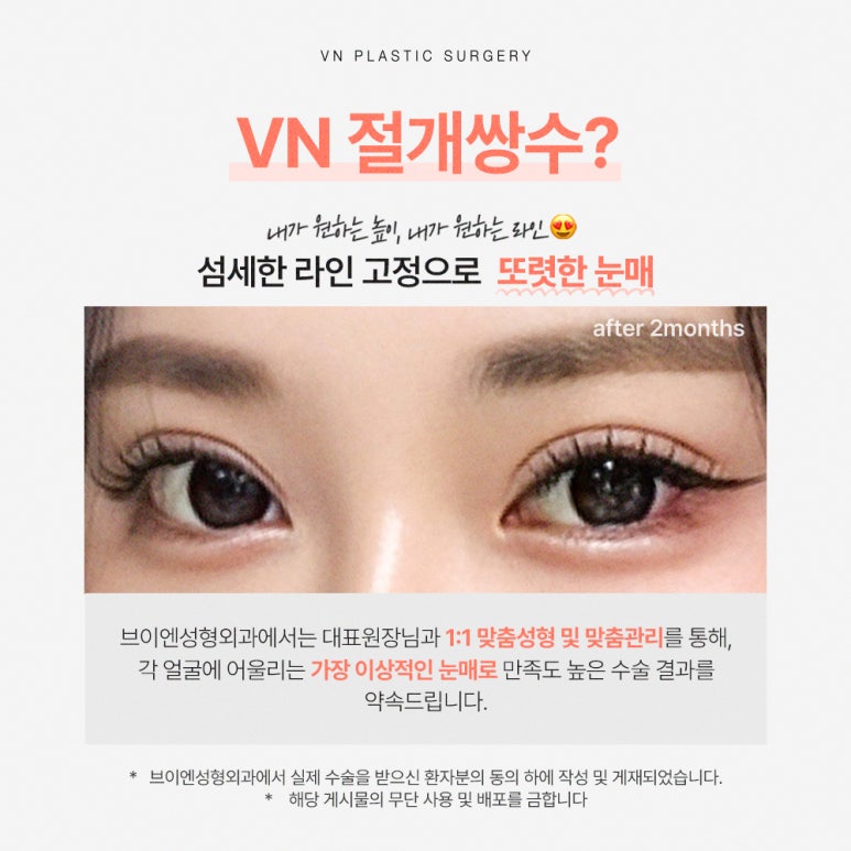 [Gangnam/Sinnonhyeon VN Plastic Surgery] Post-College Entrance Exam Double Eyelids Surgery Is Timed Perfectly Now! image 2
