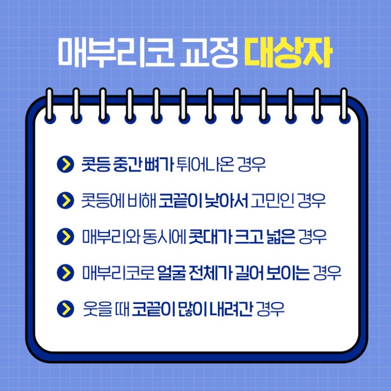 브이엔성형외과 제공｜매부리코교정 방법은? 관련 이미지 5