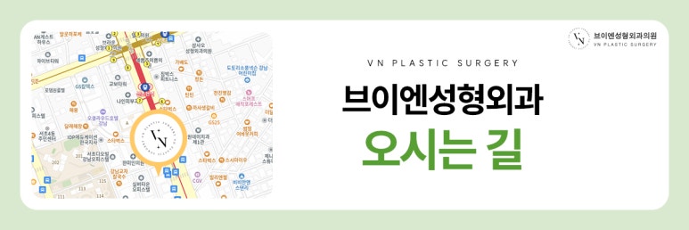 브이엔성형외과, 쌍꺼풀 수술, 부작용을 예방하고 싶다면? 관련 이미지 8