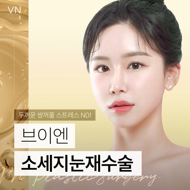 눈성형 실패 후 소세지 눈, 두꺼운 쌍꺼풀로 스트레스 받는다면? 관련 이미지 1
