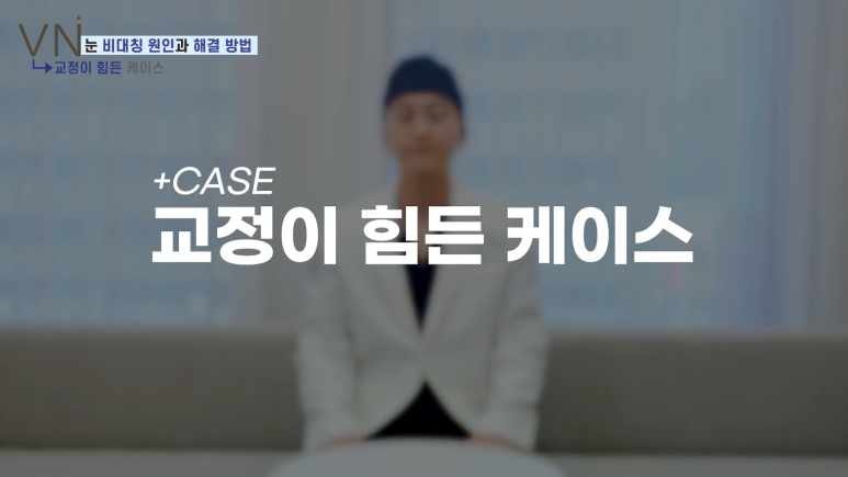 첫쌍꺼풀수술 전, 비대칭 짝눈의 원인과 해결법을 알아보자! 😀 관련 이미지 8