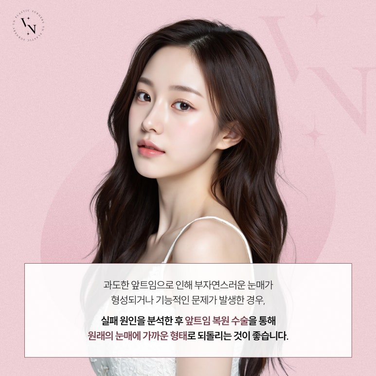 앞트임 복원 필요한 경우는? 관련 이미지 4