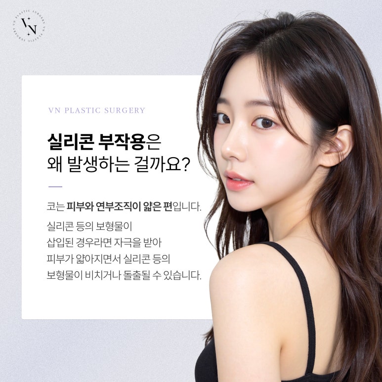 브이엔성형외과, 코수술 후 실리콘 제거를 해야 한다면? 관련 이미지 3