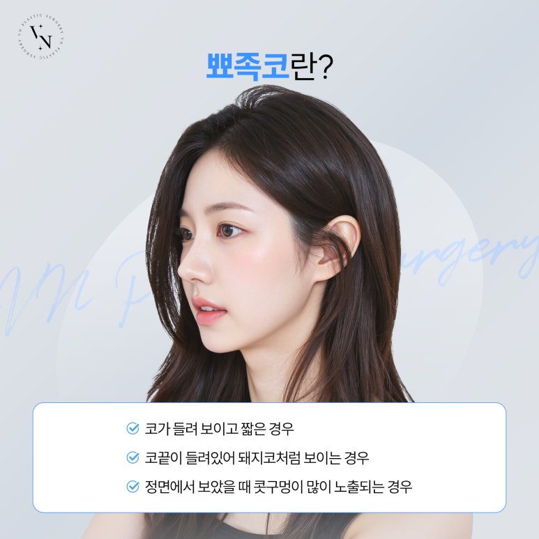 뾰족코 개선을 위한 코재수술 관련 이미지 2