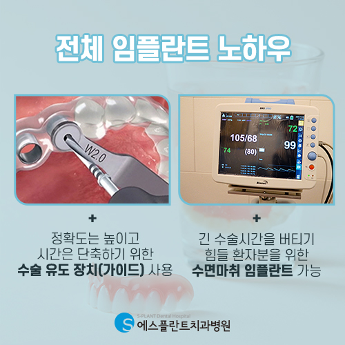 부담스러운 전체 임플란트도 실력있는 에스플란트 치과병원에서 관련 이미지 6