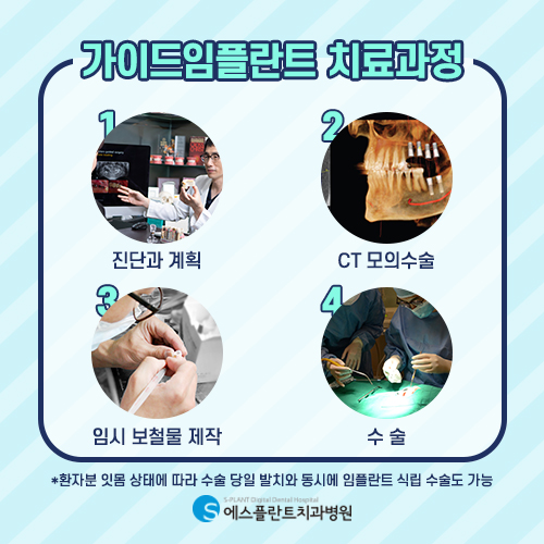 청담동 임플란트잘하는 에스플란트치과, 임플란트 믿고 맡기세요! 관련 이미지 3