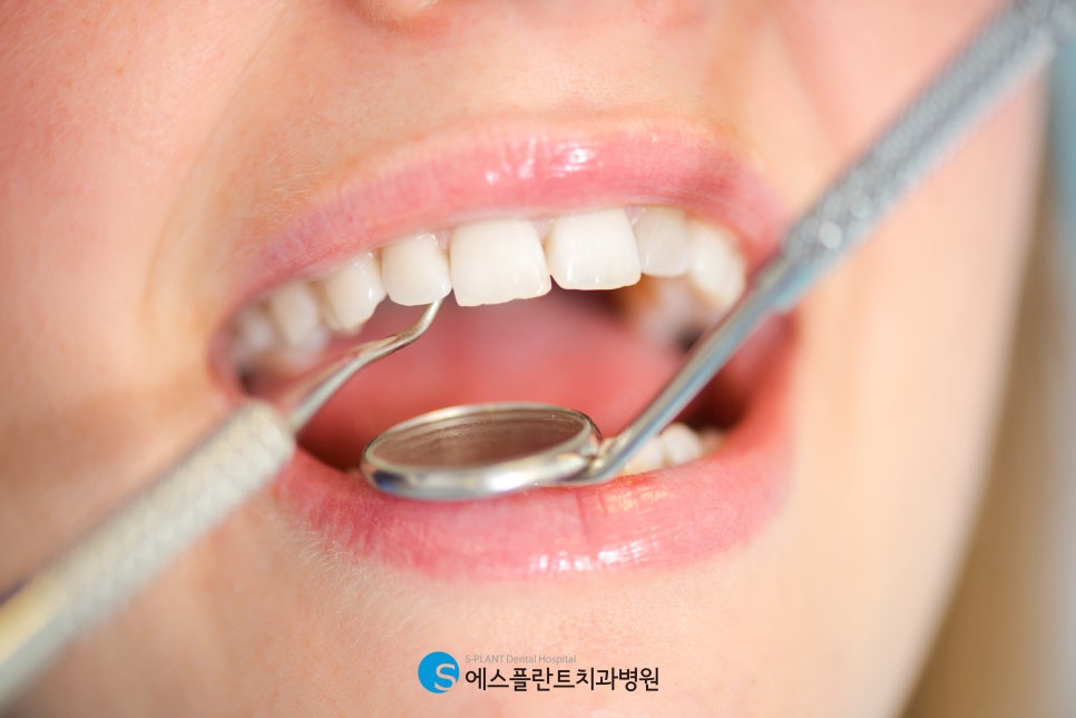 Hakdong Sageori Implant Dental Clinic: A Guide to Front Tooth Implants for a Beautiful Smile image 2