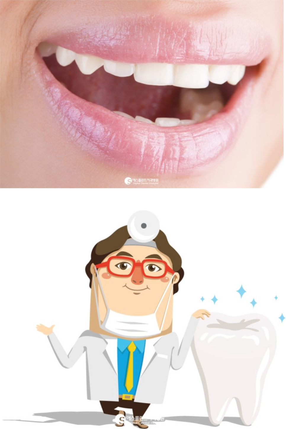 [재밌는치아상식]치아가많은내가신라의왕이로소이다! 관련 이미지 4