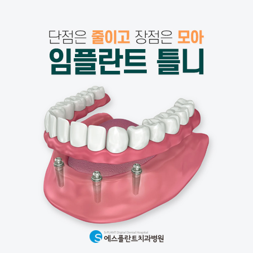 임플란트와 틀니의 장점만 모은 노인 임플란트 틀니 [에스플란트 치과병원] 관련 이미지 4