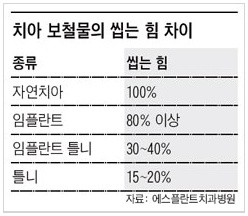 [임플란트 브릿지] 임플란트 브릿지, 임플란트 브릿지 비용 관련 이미지 4