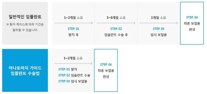 치료 기간 단축의 핵심 치아 발치후 임플란트 즉시 식립 관련 이미지 3