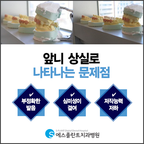 앞니 깨짐 심미성과 시간이 중요해! &ndash; 에스플란트치과병원 관련 이미지 2