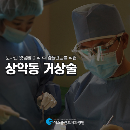 상악동 거상술 임플란트 주의사항 [에스플란트 치과병원] 관련 이미지 3