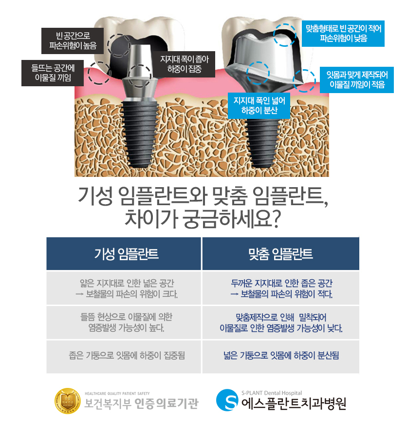 임플란트 주위염 원인과 예방법은? &ndash; 에스플란트치과병원 관련 이미지 7