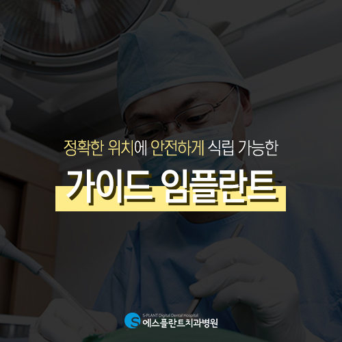 정확한 위치에 안전하게 식립 가능한 가이드 임플란트 [에스플란트 치과병원] 관련 이미지 3