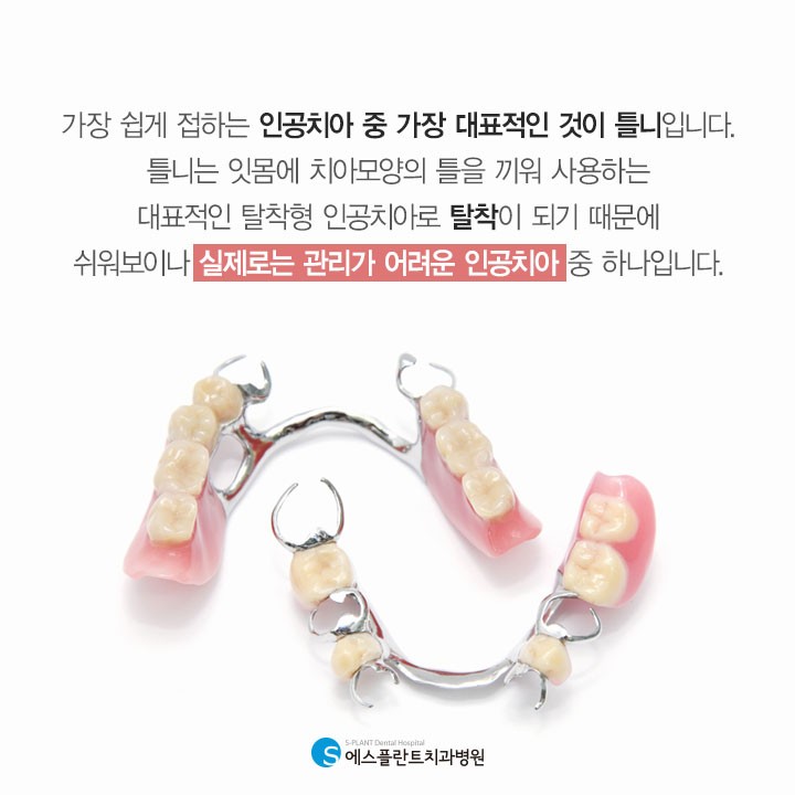 틀니, 잘못 관리하면 구강 문제를 일으킬 수 있습니다. 관련 이미지 2