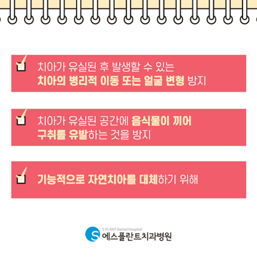 손상되고 상실된 치아를 대체하는 임플란트, 에스플란트치과에서 진행하세요! 관련 이미지 2