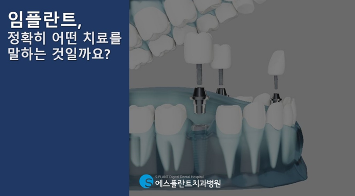 다양한 경우에 적용될 수 있는 임플란트 치료! 에스플란트치과와 함께하세요! 관련 이미지 2