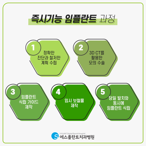 시간이 없어서 임플란트 수술을 미뤄오셨다면, 에스플란트 치과의 즉시기능 임플란트! 관련 이미지 5