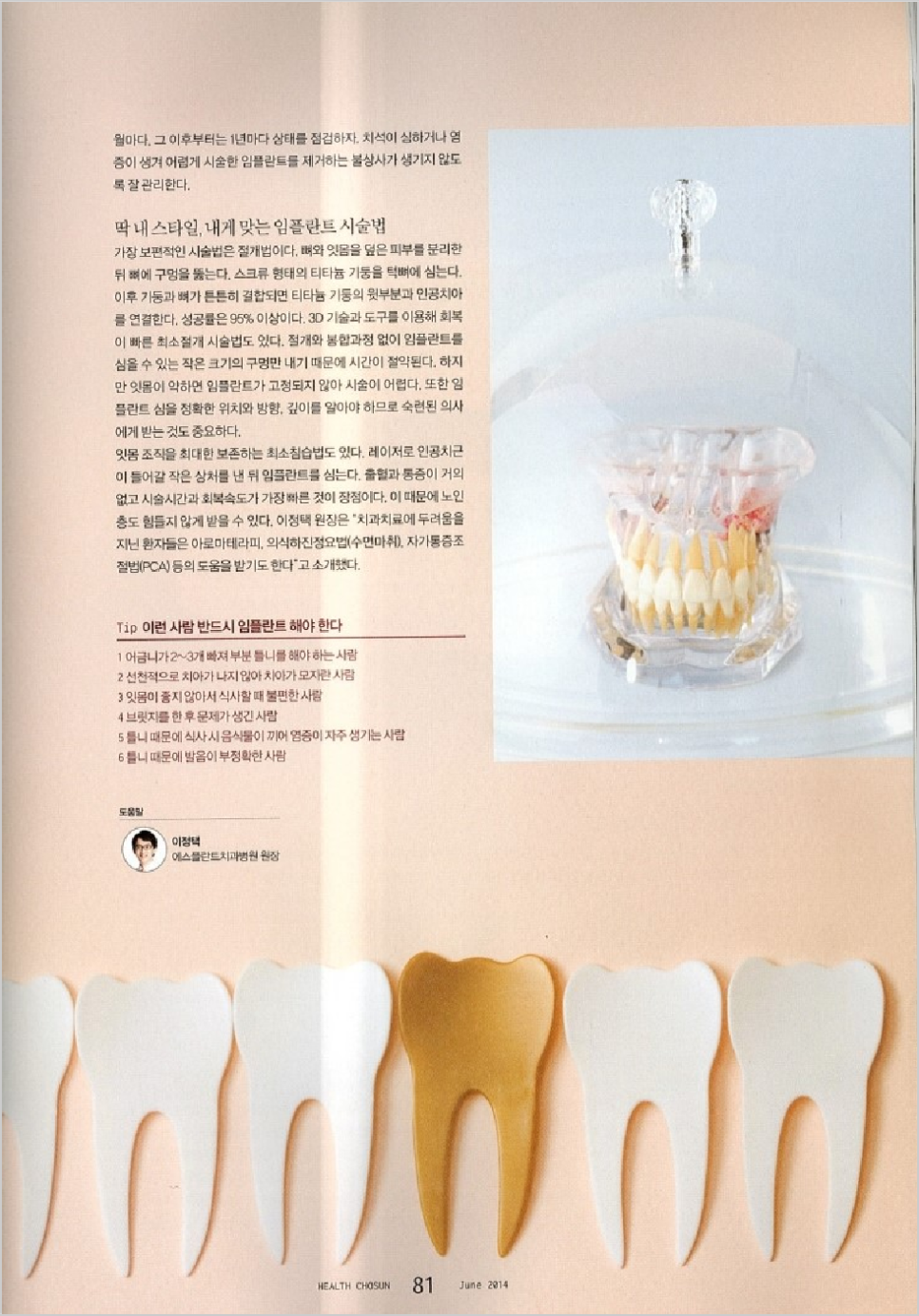 [에스플란트치과병원] 헬스조선 건강의 시작, 건치 프로젝트2 관련 이미지 3