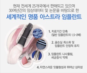[압구정로데오역 치과] 앞니 임플란트, 케이스별 맞춤 치료가 중요한 임 플란트! 관련 이미지 4