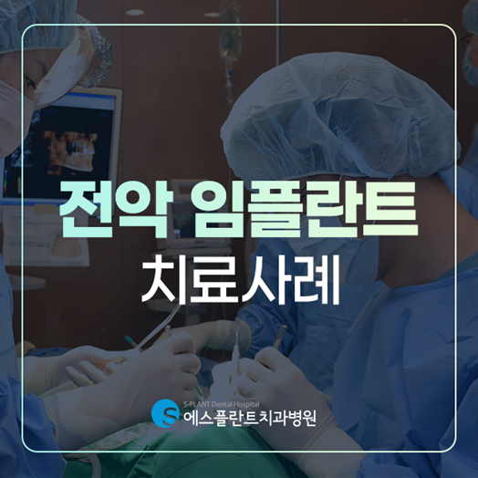 전악임플란트로 치아 기능을 회복하세요! <전악임플란트 치료사례> 관련 이미지 1