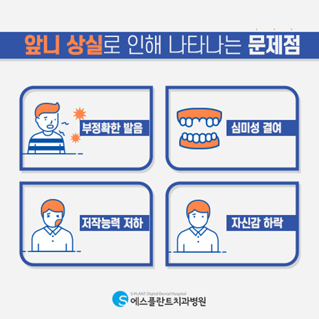 첫인상을 좌우하는 앞니를 상실했다면? 앞니 임플란트 하세요! 관련 이미지 2