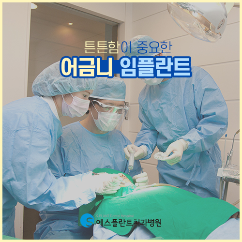 압구정 어금니 임플란트 잘하는 에스플란트 치과병원 관련 이미지 3
