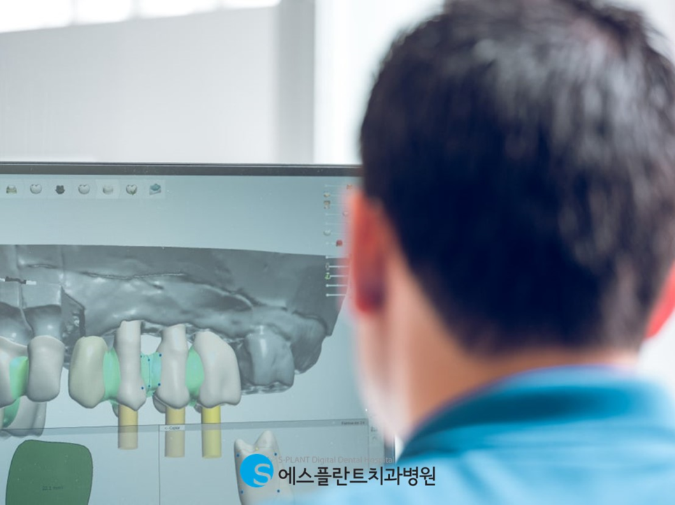 강남네비게이션임플란트로 정확도와 안전성을 높이다 관련 이미지 2