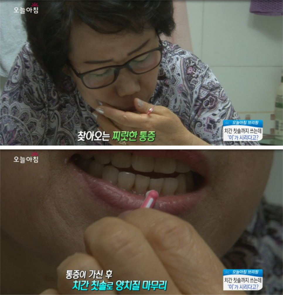 MBC생방송오늘아침_치간칫솔까지쓰면서관리해도시린이!왜?!_백 상현원장님 관련 이미지 2