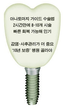 임플란트가격, 임플란트가격비교 기준은? 관련 이미지 3