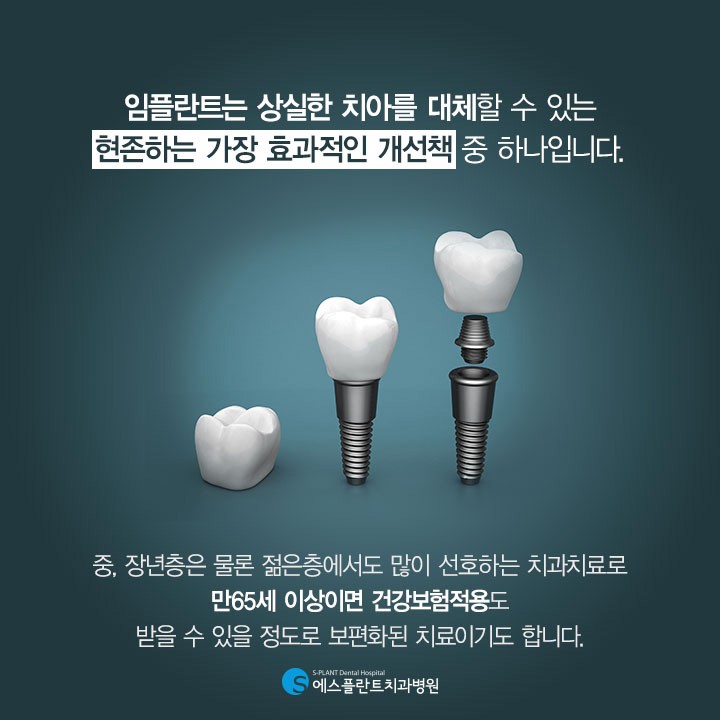 임플란트 재수술, 일반수술과 다른점은? 관련 이미지 2