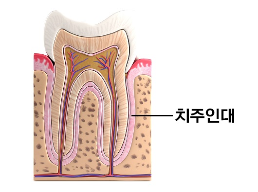 임플란트 주위에 질환이 쉽게 발생하는 이유 [에스플란트 치과병원] 관련 이미지 2