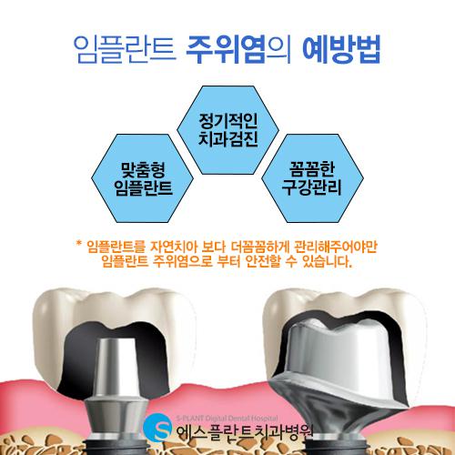 임플란트주위염 미리 예방하는 방법 없을까요? – 에스플란트치과병원 관련 이미지 6