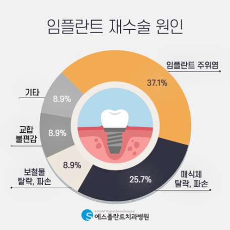 임플란트주위염의 원인과 예방법은 무엇일까요?<에스플란트치과병원> 관련 이미지 2