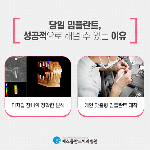 바쁜 현대인을 위한 빠른 치료, 에스플란트 치과병원의 당일 임플란트 관련 이미지 6