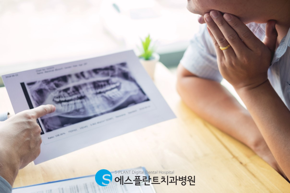 Apgujeong Cheongdam Full-Mouth Implant: How Can You Receive a Stable Placement?! image 2