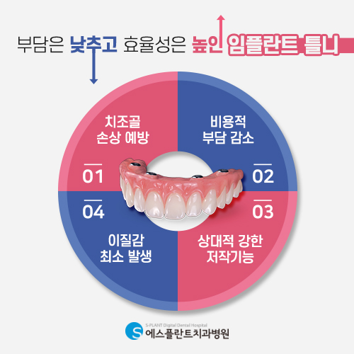 틀니와 임플란트의 장점은 모으고 단점은 보완한 노인 임플란트 틀니 [에스플란트 치과병원] 관련 이미지 4
