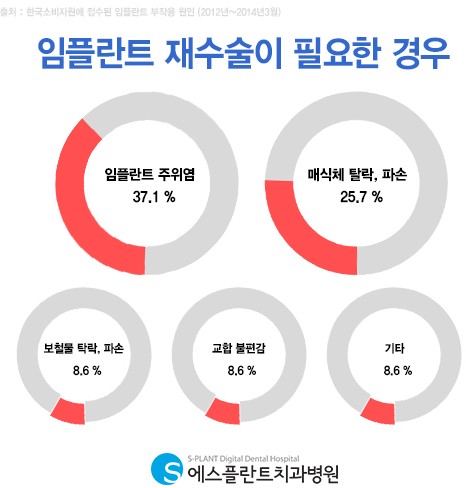 임플란트 실패는 없다. 임플란트 재수술 에스플란트치과병원이 해결해 드립니다. 관련 이미지 2
