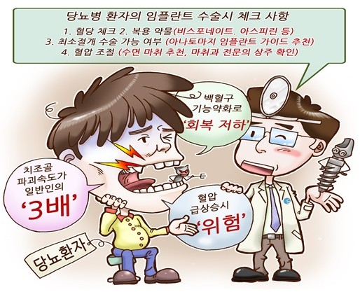 임플란트, 긴 시간·부작용에 주저? 관련 이미지 2
